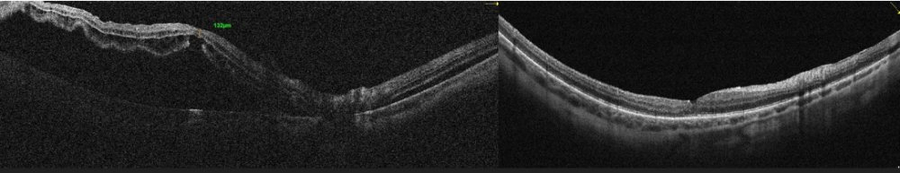 Slider image (9) Dr Nikolaos I Dervenis Eye Clinic